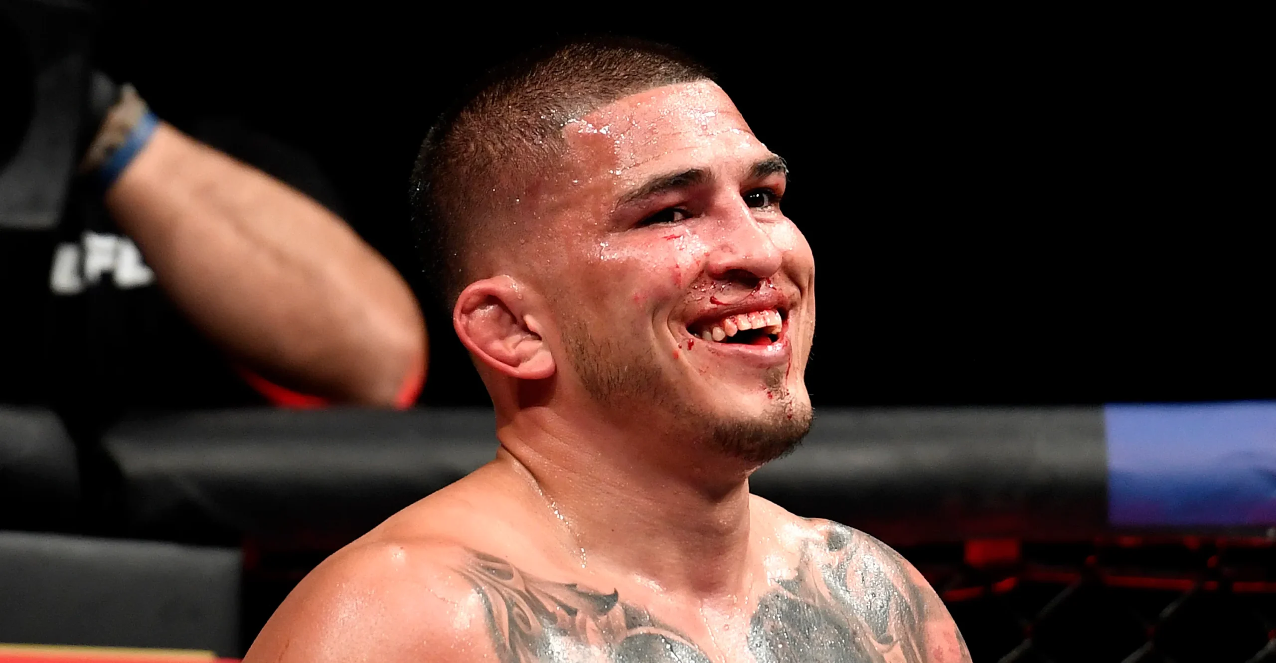 Anthony Pettis Ungkap Kisah di Balik Kotak Wheaties: Seharusnya Jon Jones